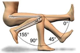 Clinical Examination of Knee | Knee Specialist in Mumbai | Dr. Amyn Rajani