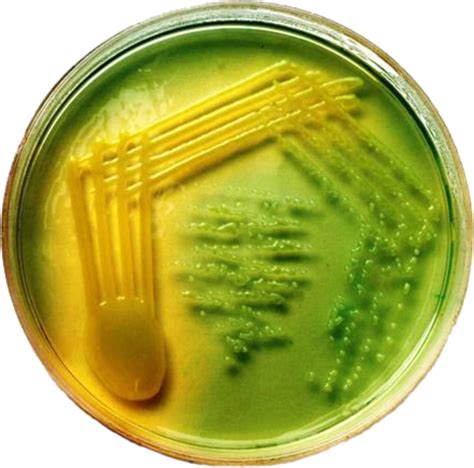 Klebsiella Pneumoniae On Cled Agar