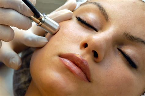 What Is A Microdermabrasion Facial Dermatology Center Of Acadiana