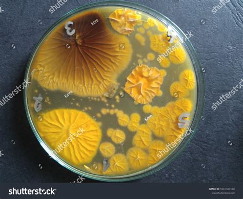 Fungal Colonies On Sabouraud Dextrose Agar Foto Stock 1861380148