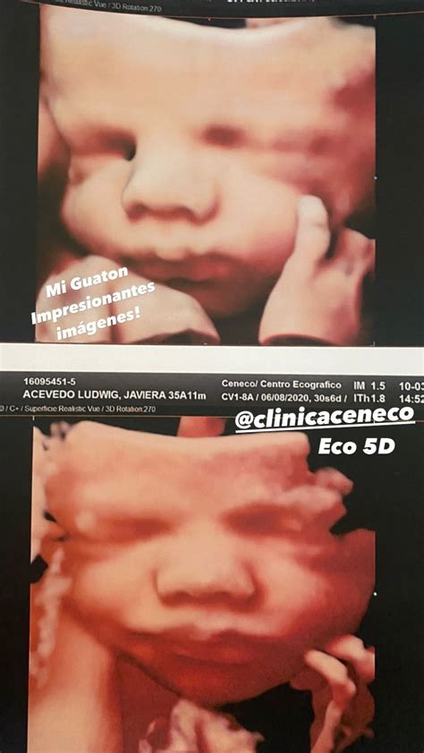 Impresionante Javiera Acevedo Sorprende Con Foto De Su Hijo En