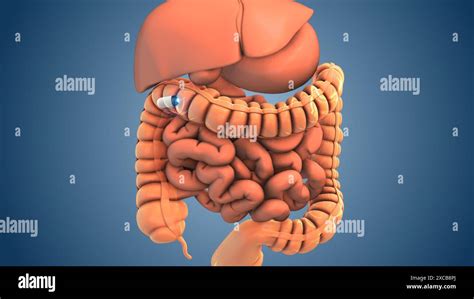 Medical Concept Of Capsule Endoscopy Technique Stock Photo Alamy