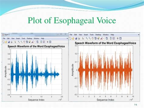 Esophageal Speech Recognition Using Artificial Neural Network Ann