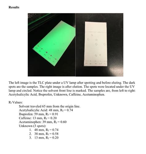 Identification Of Compounds By Tlc And Uv Lamp 43 Off