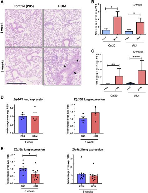 Intracellular Mislocalization Of Zfp L Zfp L In Airway Epithelial