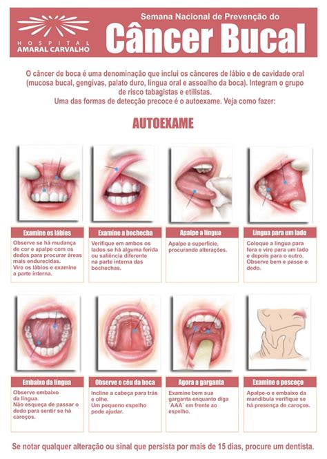 Amaral Carvalho Alerta Para Importância Da Prevenção Do Câncer De Boca