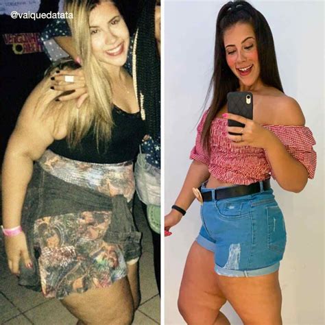 Ex Obesa Carioca Compartilha Como Perdeu Quilos Sem Cirurgia