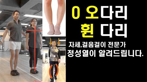 걸음걸이 교정 병원 오다리 교정 휜다리교정운동법 정성열이 알려드립니다 바른자세와 걸음걸이부터 고쳐야 합니다 83 개의