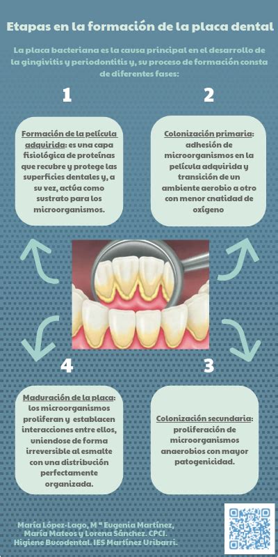 Infografía Interactiva Sobre Periodoncia Periodoncia Higienista