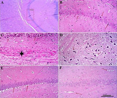 Photomicrograph H&E stained rat’s hippocampual at CA1 region showing ... 