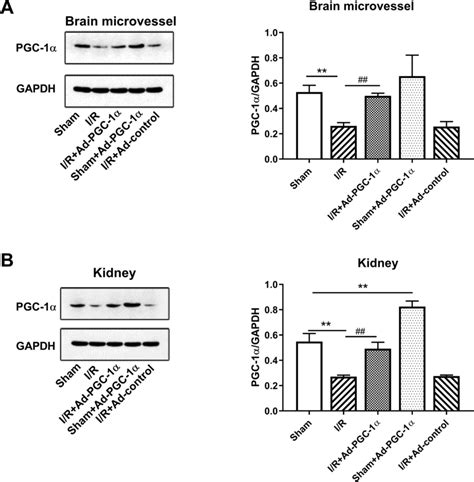 PGC 1α expression in brain microvessel and kidney a Western blot