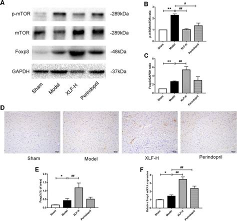 The Expressions Of MTOR P MTOR And Foxp3 In Rat Hearts A The Protein