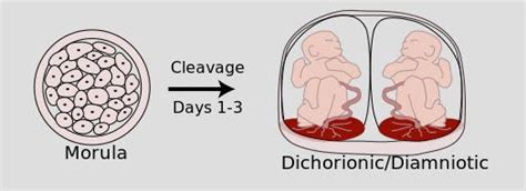 La Différence Entre Monozygote Et Dizygote Parentsfr