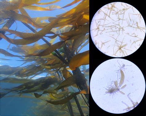 Effects Of Ocean Warming Across The Life Cycle Of Bull Kelp College