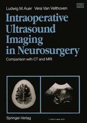 Intraoperative Ultrasound Imaging In Neurosurgery Comparison With CT