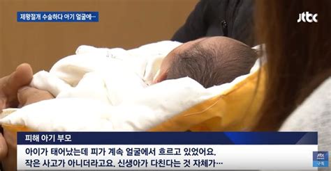 제왕절개 수술 중 신생아 얼굴에 칼자국 남긴 의사가 상처는 잘 아문다고 말하다