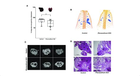 Effect Of Phenacetinum 4CH On Melanoma Metastatic Dissemination 1 X