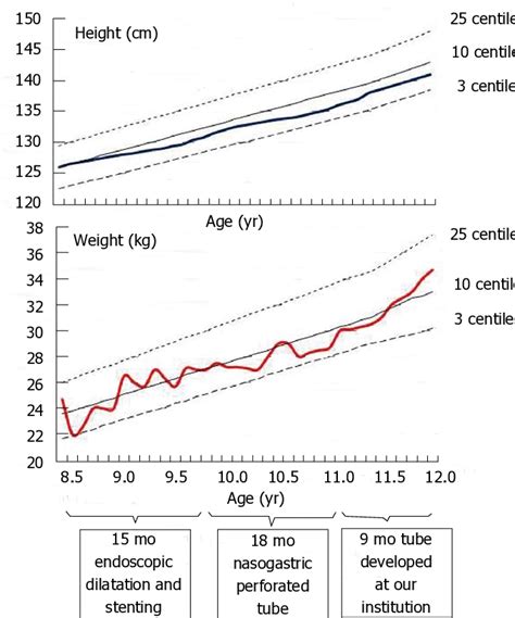 Patient's grow charts. Height and weight of the patient during three ...