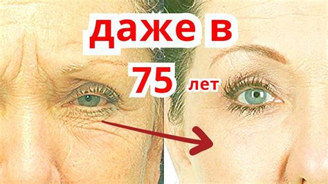 Морщин Нет Как в 30 Лет! Маска От Глубоких Морщин Вокруг Глаз /Рецепт ...