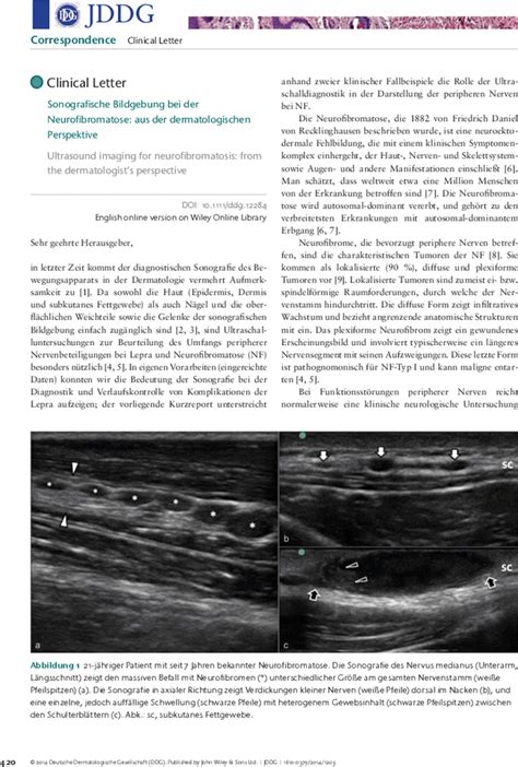 Sonografische Bildgebung Bei Der Neurofibromatose Aus Der