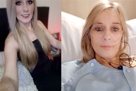 My Boob Job Turned Me Into A Real Life Zombie That S Life
