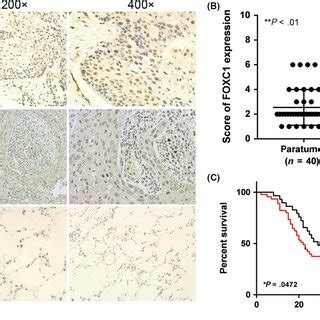 Overexpression Of Forkhead Box C Foxc Promoted Cell Proliferation