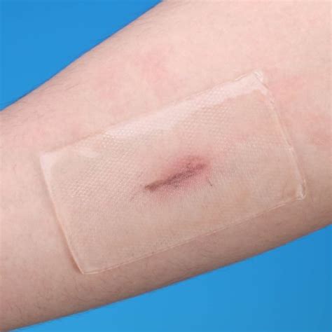 Silicone Scar Gel Sheet For Burns Silicon Scar Sheet Dressing