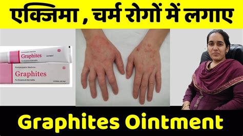 Graphites Ointment Homeopathic Medicine Uses Ointment Cream For