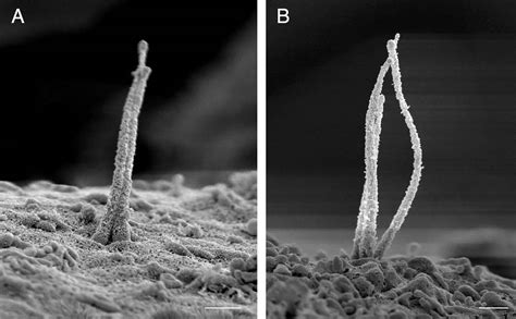 Scanning Electron Microscopy Of Human Islet Cilia Pnas