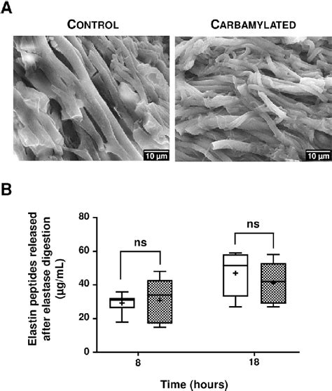 Impact Of Carbamylation On Elastin Morphology And Sensitivity To