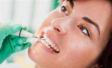 Qu Hace Un Dentista Durante Una Limpieza Dental Ortoimplants Premium