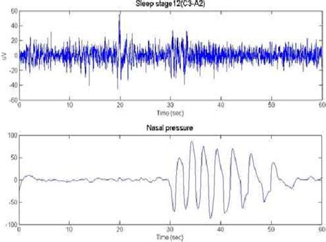 Figure From Eeg Characteristic Analysis Of Sleep Spindle And K