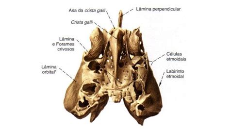 Neurocr Nio Frontal Parietal Occipital Temporal Esfenoide E