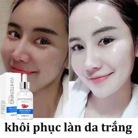 GÌ CŨng RẺ Tinh Chất Làm Trắng 30ml Tinh Chất Trắng Da Nicotinamide Làm