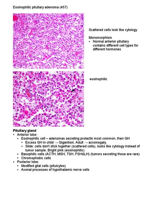 Endocrine Glands Pathology Endocrine Diseases Thyroid