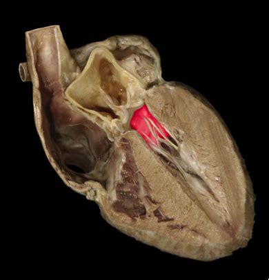 NPLEX 2 Cardiology Valvular Disorders Flashcards Quizlet