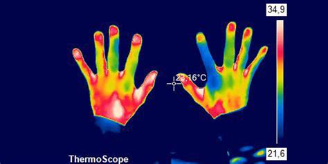 Thermographie sportärztezeitung