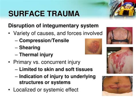 Ppt Surface Trauma Powerpoint Presentation Free Download Id 5057665