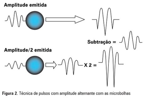 SciELO Brasil Ecocardiografia contraste no infarto do miocárdio