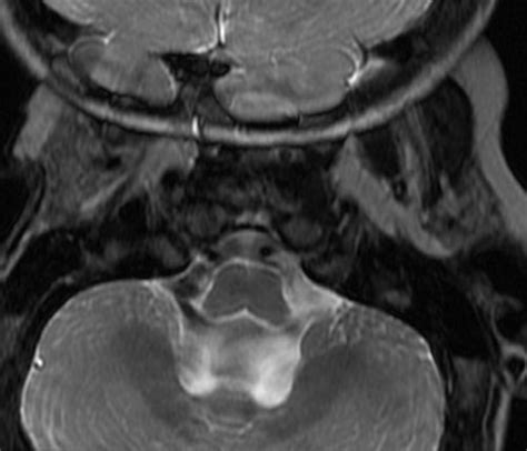 Phase Encoding Direction Questions And Answers In Mri