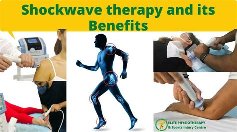 Shockwave Therapy and Its Benefits