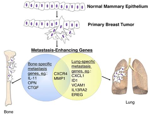 Metastasis Gets Site Specific Cancer Cell