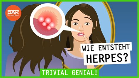 Wie Entsteht Herpes Trivialgenial Dak Gesundheit Youtube