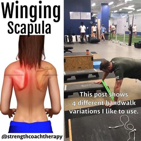 Winging Shoulder Blades Causes And Solutions