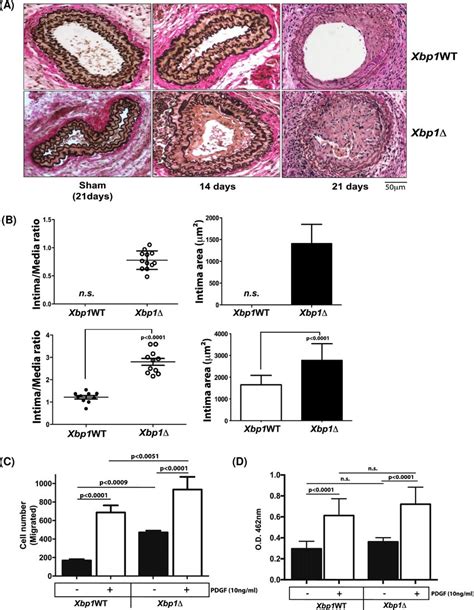 Increased Neointimal Hyperplasia After Carotid Artery Ligation In Xbp1 Download Scientific