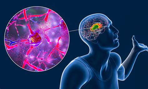 Novel Screening Reveals Drug Candidates For Huntingtons Disease