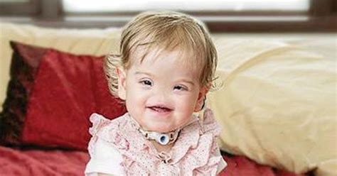 Guilty Mom Opens Up About Baby Born With No Nose Flipboard