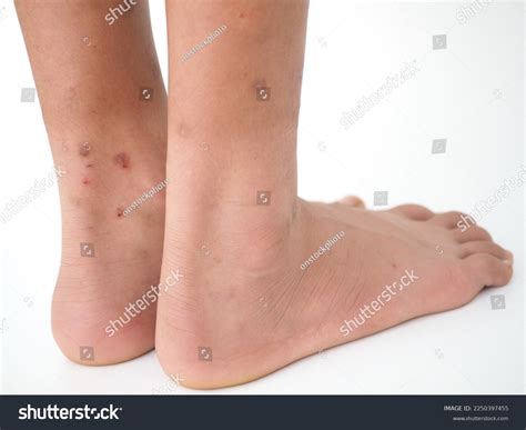 Painful Leg Boy Images Stock Photos Vectors Shutterstock