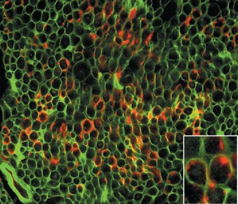 Figure 1 From Axonal Regeneration Into Acellular Nerve Grafts Is