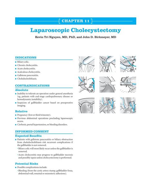 Ch. 11: Laparoscopic Cholecystectomy